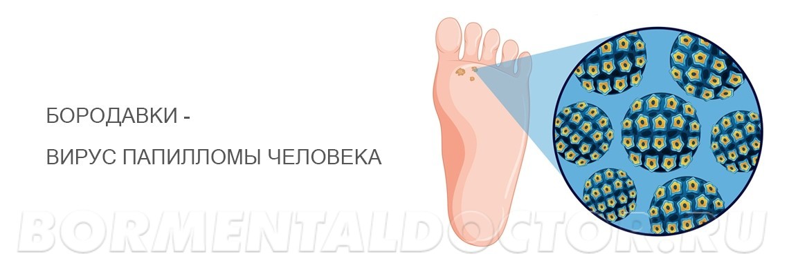 Папилломы и бородавки